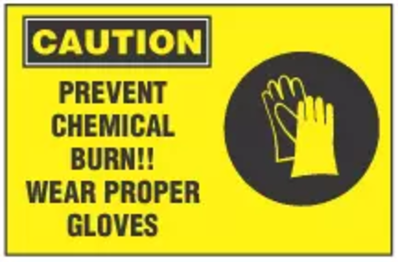 Severe Burns in the Workplace